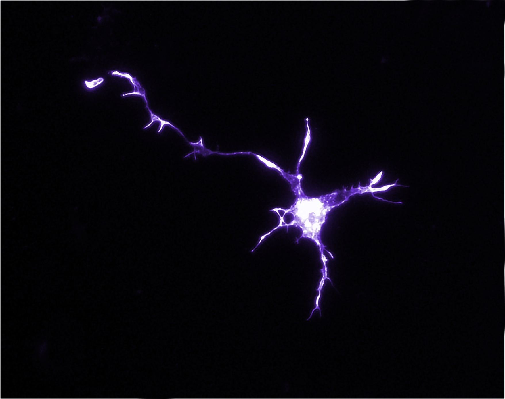 neurone neurone