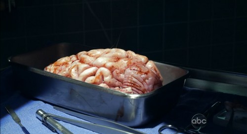 cerveau flash forward